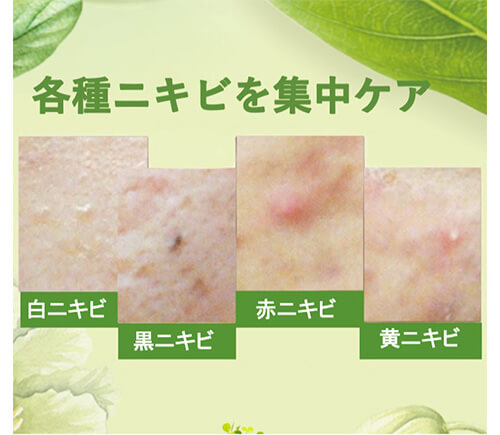 AC LOTION 薬用 （医薬部外品）｜株式会社エルシックス